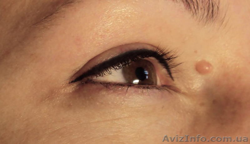 Перманентный макияж (татуаж) - <ro>Изображение</ro><ru>Изображение</ru> #10, <ru>Объявление</ru> #8420